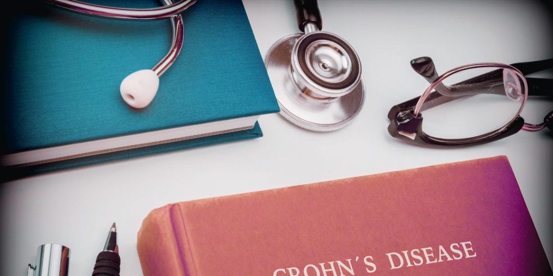 Could Idiopathic Pancreatitis Be a Prognostic Clue in Crohn’s Disease