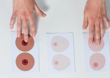 Visual breast examination models used for diagnosing breast abscess