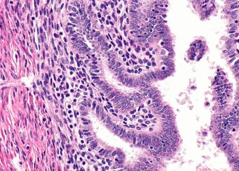 Diagnosis and Medical Imaging of Adenomyosis