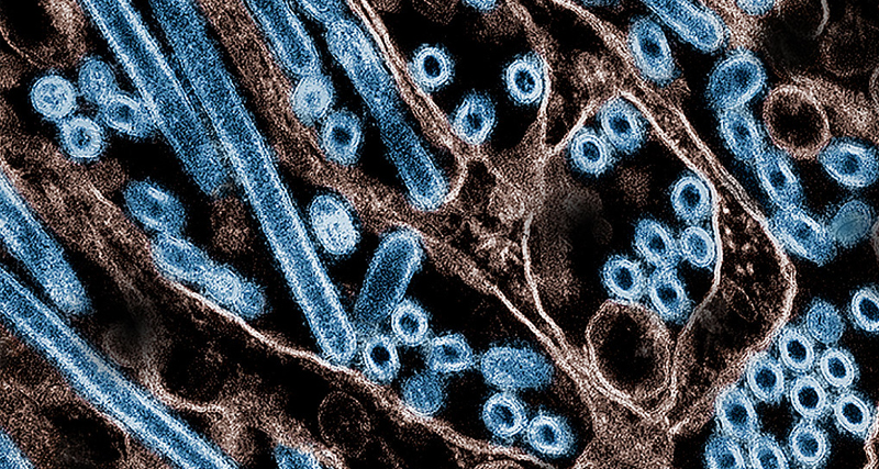 Microscopic image of the bird flu virus particles used to illustrate diagnostic testing and virological analysis.