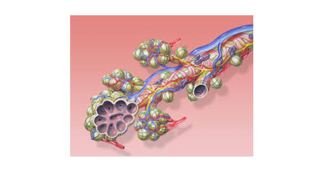 Diagnosis and Treatment of ARDS