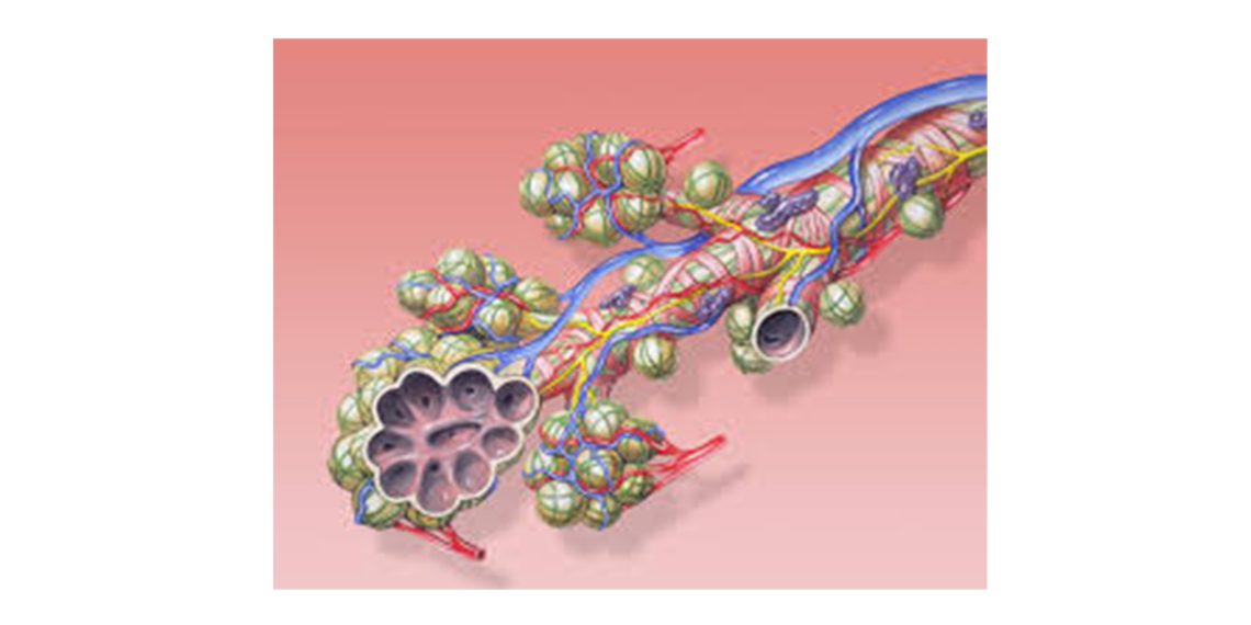 Diagnosis and Treatment of ARDS