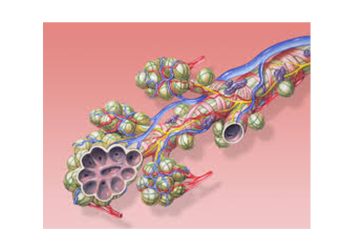 Diagnosis and Treatment of ARDS