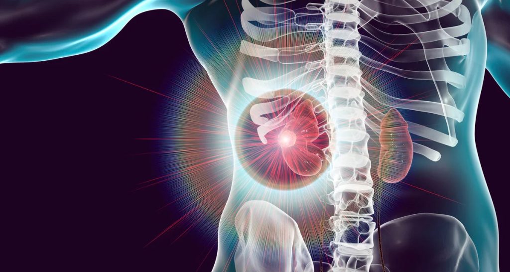 Diagnosis and Treatment of Acute Kidney Injury
