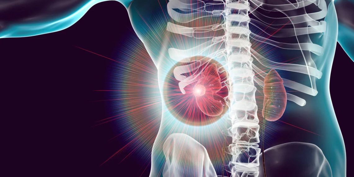 Diagnosis and Treatment of Acute Kidney Injury