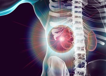 Diagnosis and Treatment of Acute Kidney Injury