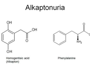 Diagnosis of Alkaptonuria