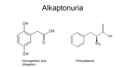 Diagnosis of Alkaptonuria