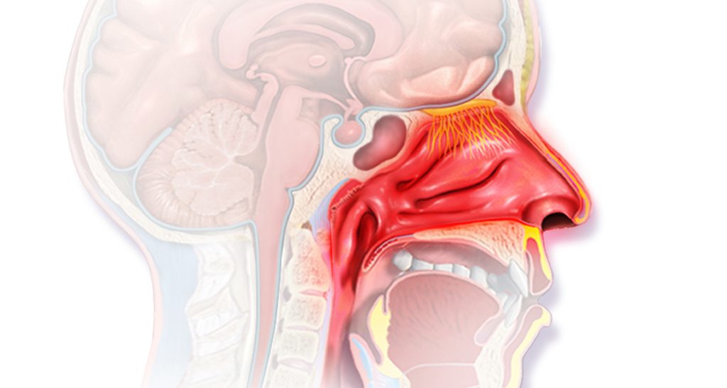 Diagnosis of Allergic Rhinitis