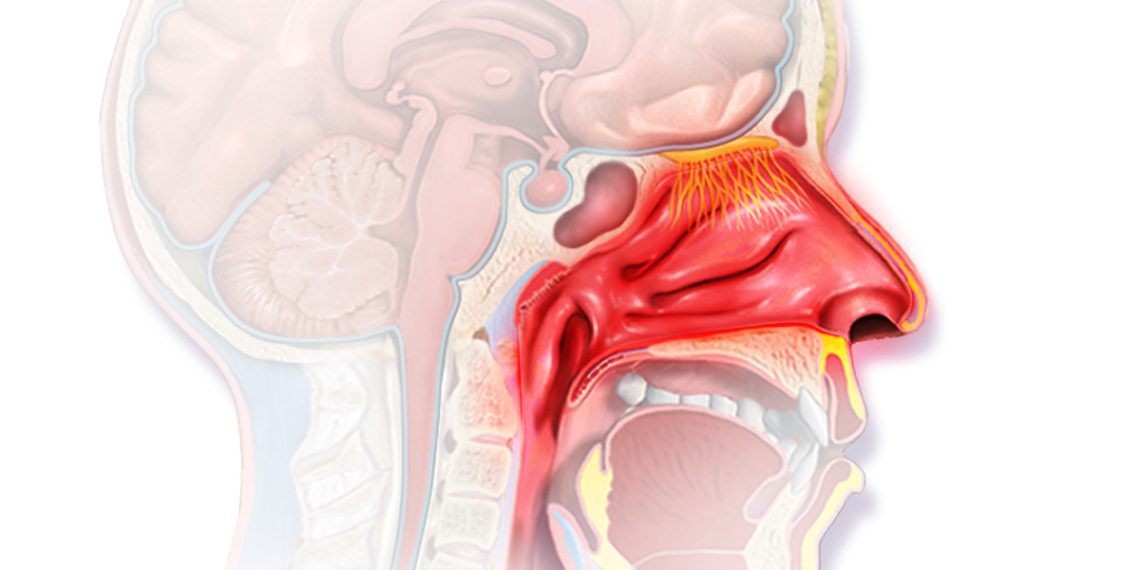 Diagnosis of Allergic Rhinitis