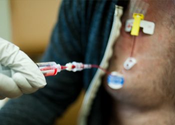 Diagnosis of Amyloidosis