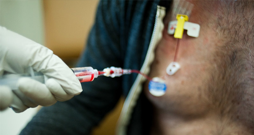 Diagnosis of Amyloidosis