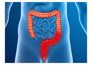 Diagnosis of Anal Cancer