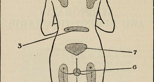 Diagnosis of Anal Fissure