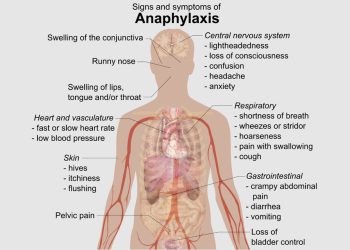 Diagnosis of Anaphylaxis