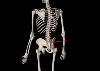 Diagnosis of Ankylosing Spondylitis