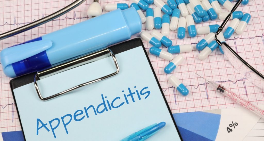 Diagnosis of Appendicitis