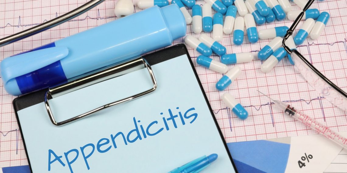 Diagnosis of Appendicitis