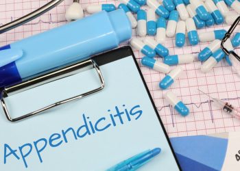 Diagnosis of Appendicitis