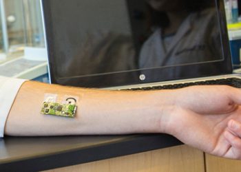 Diagnosis of Atopic Eczema