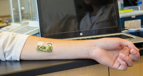 Diagnosis of Atopic Eczema