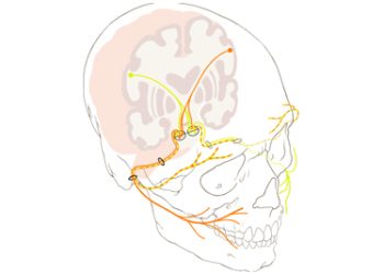 Medical illustration of cranial nerve pathways involved in Bell’s palsy, showing the facial nerve and its branches across the skull.