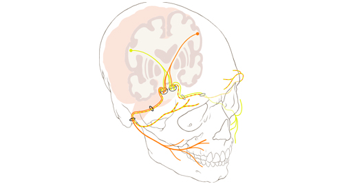 Medical illustration of cranial nerve pathways involved in Bell’s palsy, showing the facial nerve and its branches across the skull.