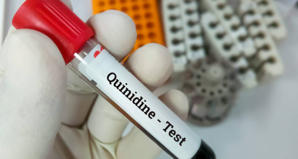Gloved hand holding a blood sample tube labelled Quinidine Test