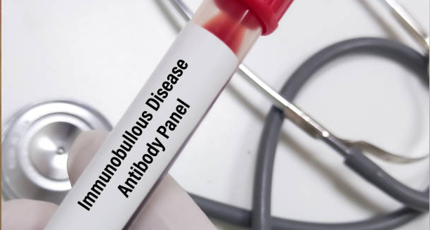 Blood sample labelled "Immunobullous Disease Antibody Panel" with stethoscope in background