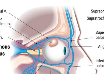 Medical diagram showing veins connected to the cavernous sinus around the eye and face