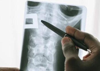 Close-up of a spinal X-ray being examined for vertebral fractures