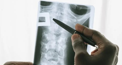 Close-up of a spinal X-ray being examined for vertebral fractures