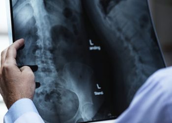 Doctor examining X-ray scan showing pelvic bones