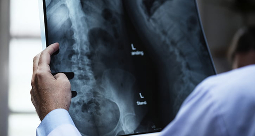 Doctor examining X-ray scan showing pelvic bones