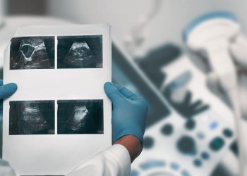 How Gallstones Are Diagnosed