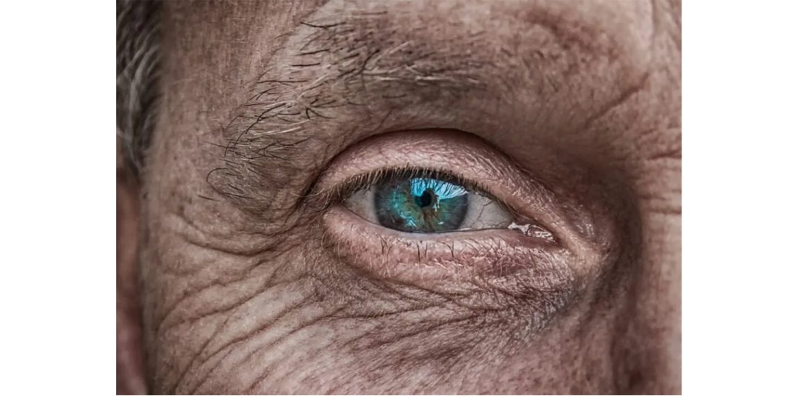 Living with AMD – Support and Resources