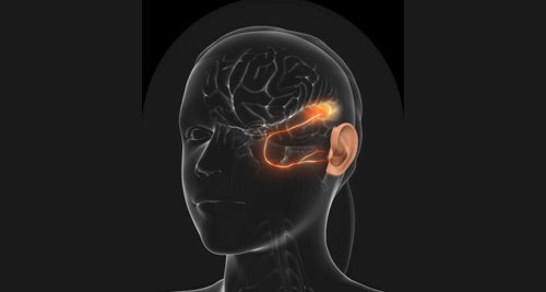 Living with Auditory Processing Disorder