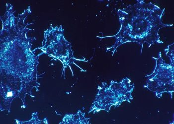 Microscopic view of cancer cells, representing treatment options for bladder cancer at the cellular level.