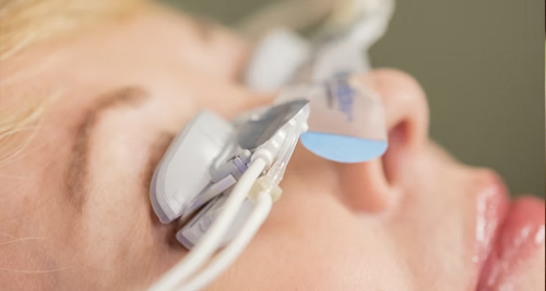 Close-up of a patient receiving thermal eyelid therapy to treat blepharitis using specialised medical equipment.
