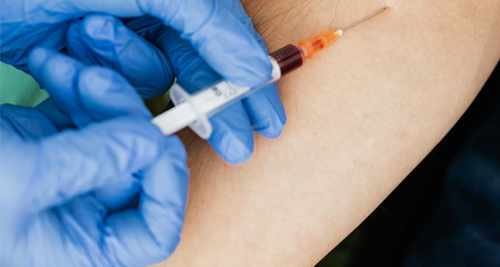 Close-up of a healthcare worker drawing fluid with a syringe, suggesting treatment of a skin infection or boil.