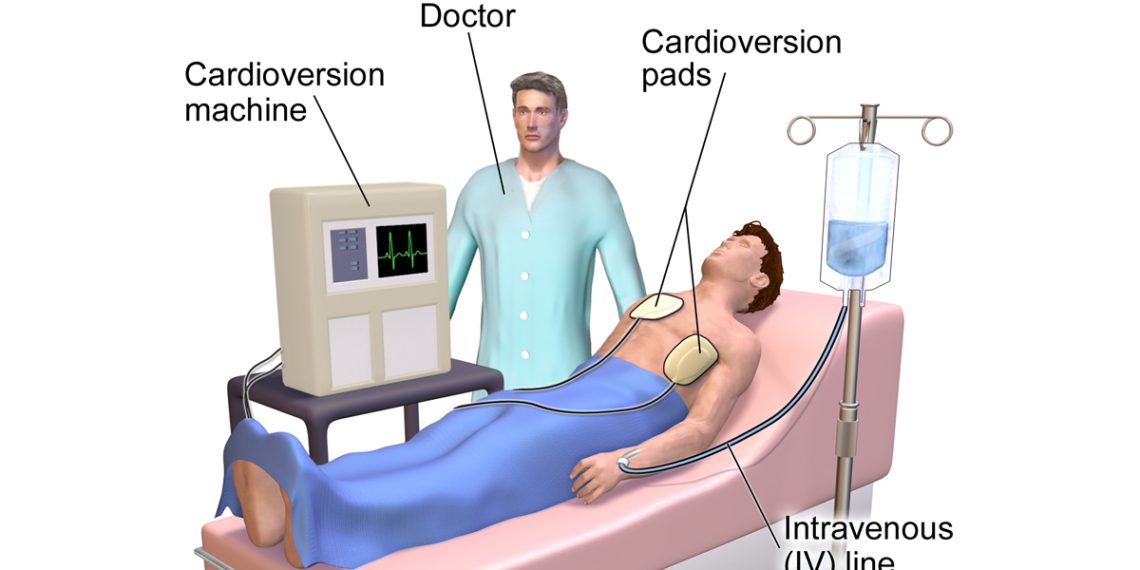 Treatment and Management of Atrial Fibrillation