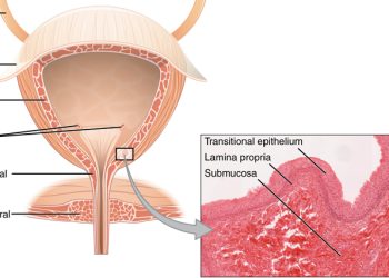 Medical diagram of the female urinary system with microscopic tissue view, illustrating urethral and epithelial structures.