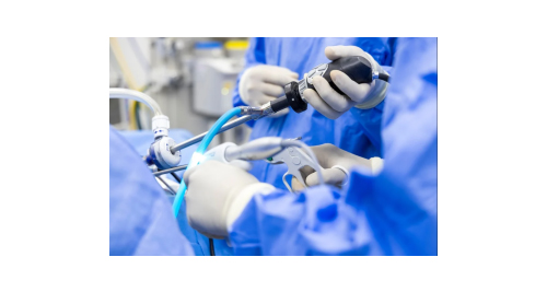 Treatment for Anal Cancer