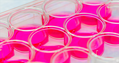 Treatment for Antiphospholipid Syndrome