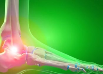 Treatment of Athlete’s Foot