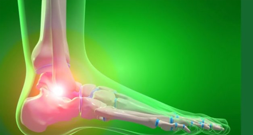 Treatment of Athlete’s Foot