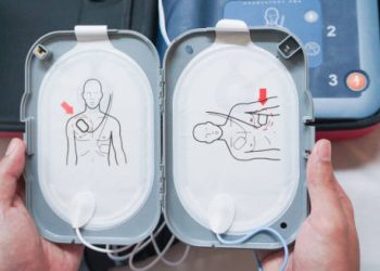 AED pad placement diagram for cardiac emergency response