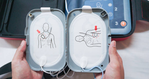 AED pad placement diagram for cardiac emergency response