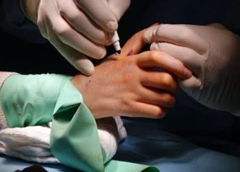 Doctor performing carpal tunnel release surgery on a patient’s hand