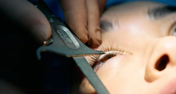 Child undergoing cataract eye surgery